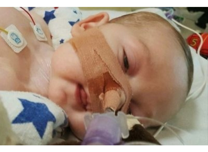 Charlie Gard 